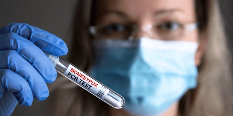Mpox: 32 casos confirmados en Costa de Francia