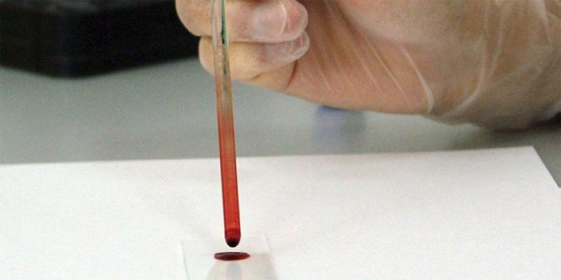 Pourquoi peu de laboratoires privés proposeront la PCR