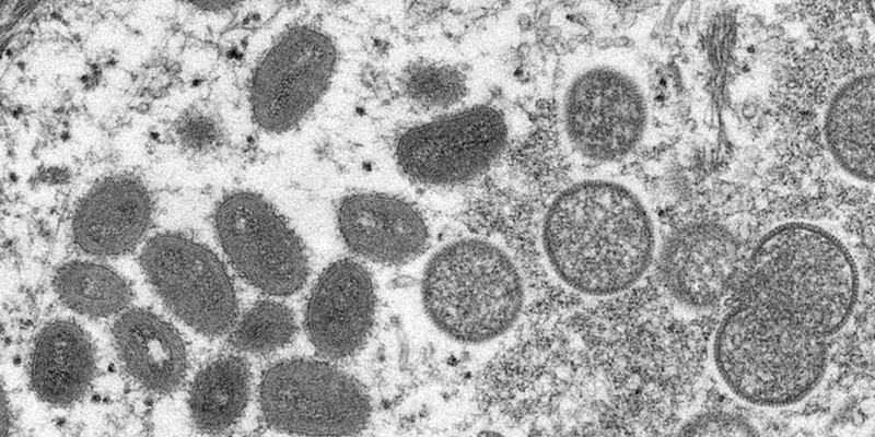 Premier cas confirmé de variole du singe au Maroc